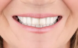 Before dental implants