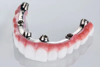Full Zirconia Bridge